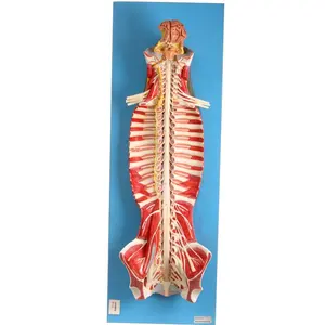 GD/A18102 Spinal Cord in the Spinal Canal(medical model, anatomical model)