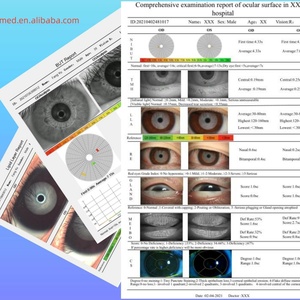 Équipement ophtalmique infrarouge pour l'examen de la surface oculaire, analyseur de surface oculaire pour l'imagerie des glandes de Meibom, appareil DEA50 - Product Image 6