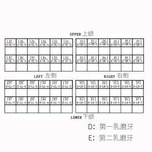 <span class=keywords><strong>Couronne</strong></span> dentaire en acier inoxydable pour enfants, de haute qualité, certifiée CE, garantie 3 ans - Product Image 4