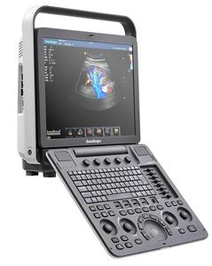 Appareil d'échographie Doppler couleur Sonoscape S8EXPV de qualité supérieure, équipement d'échographie pour hôpital et clinique - Product Image 1