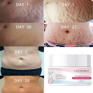 Traitement des vergetures Crème anti-vergetures post-partum Produits d'élimination des cicatrices pour la vente au détail - Product Image 2