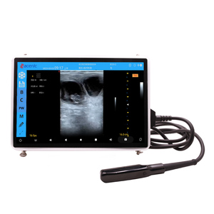 Échographe Doppler Couleur Portable Étanche IPX6 ECI-X7 pour Usage Vétérinaire avec Affichage B/C/PW, Utilisation Facile, Téléchargement sans Fil via WIFI - Product Image 1
