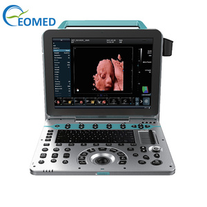 EO-P50 alat diagnosa ultrasonik portabel warna berkualitas tinggi dengan layar LED medis definisi tinggi 15 inci - Product Image 1