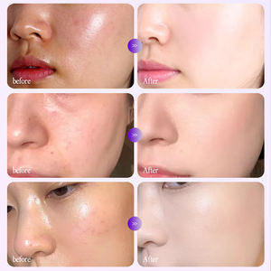 <span class=keywords><strong>Masque</strong></span> en feuille de collagène apaisant pour peaux sèches OEM, <span class=keywords><strong>masque</strong></span> facial en hydrogel nourrissant en profondeur, <span class=keywords><strong>masque</strong></span> de nuit hydratant pour le visage - Product Image 3