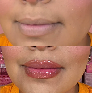 Gel de soin des lèvres populaire Vitamine C lèvre repulpante marque privée - Product Image 1