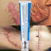 Gel Réparateur Rapide pour Cicatrices d'Acné et Vergetures, Crème Anti-Vergetures et Cicatrices pour le Corps et le Visage, Effet Raffermissant Post-Abdominoplastie