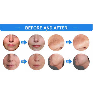 2025年最高のサロンフェイシャルスパマシン多機能スキンケア若返り酸素マシン - Product Image 2