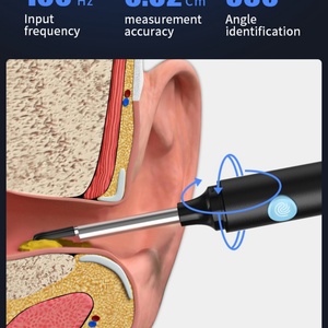 Outil de nettoyage d'oreilles électrique sans fil Wi-Fi, kit d'élimination du cérumen, otoscope 1080P avec caméra et lumière pour le nettoyage des oreilles - Product Image 4