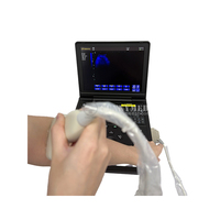 Machine à ultrasons portable échocardiographie noir et blanc Balayage animaux multisonde Machine à ultrasons numérique pour ordinateur portable