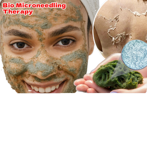 Terapia de Biomicroneedling OEM/ODM con Espículas de Esponja para Eliminar el Acné del Rostro y la Nariz, Antialérgico, Sin Sulfatos, Sin Ácidos, Sin Uso Médico - Product Image 1