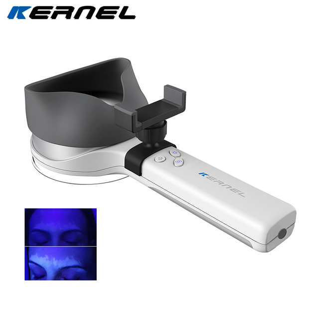 Clinical Dermoscopy Wood's Lamp Skin Analysis Woods Lamp Dermoscope Dermascope