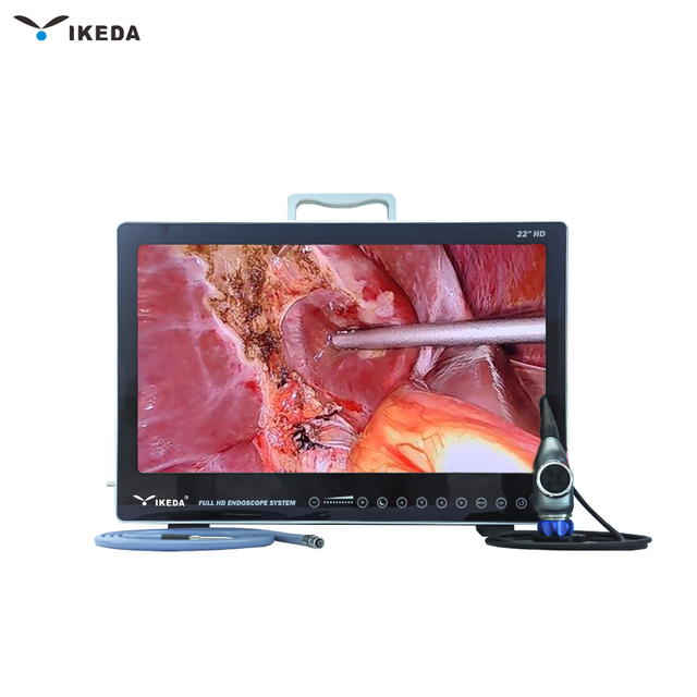 YKD-9122 Portable All-in-One HD Endoscopy System for ENT Procedures Electric Power Source