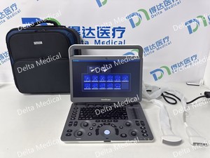 Ecógrafo Veterinario Portátil Sonoscape E2 ProV con Doppler Color para Diagnóstico de Gestación Animal, Escaneo Abdominal y MSK - Product Image 2