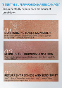 Crema Riparatrice <span class=keywords><strong>Dermatologica</strong></span> con Collagene Ricombinante, Centella e Allantoina per Pelli Sensibili - Product Image 6