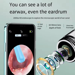 Limpiador de Oídos Inalámbrico con Cámara LED de 5MP, Cuchara de Metal y Goma Inteligente para Remover Cera, con Wifi, Hecho en China - Product Image 5