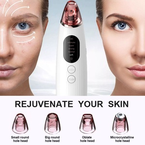 Stylo de beauté chauffant électrique pour les yeux, avec lumière colorée vibrante, ionique et chaud, appareil de massage oculaire et applicateur de crème - Product Image 6