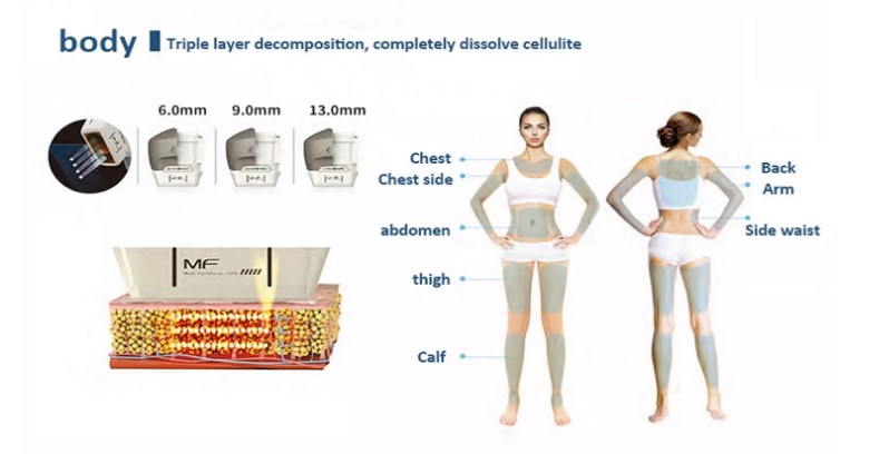 2022 2 Handle Dual Control 7D Hifu Machine For Skin Tightening And Body Slimming
