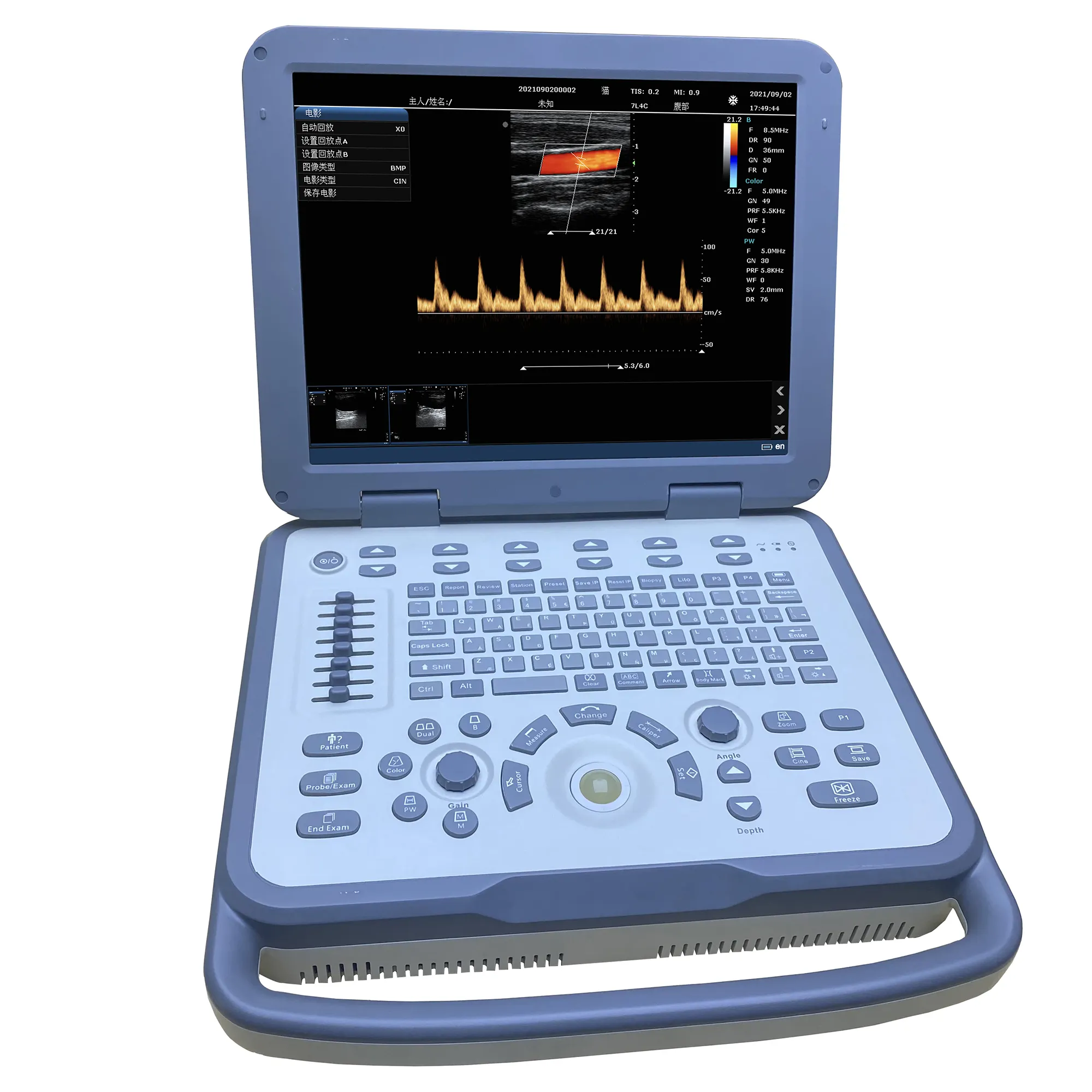 Scanner digital veterinário, instrumentos de ultrassom, sistema de ultrassom