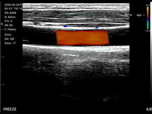 Color Doppler 7,5 Mhz 10Mhz 128 elementos WiFi escáner de ultrasonido inalámbrico sonda lineal PW <span class=keywords><strong>software</strong></span> de ultrasonido - Product Image 4