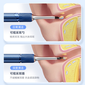 High-Definition Intelligent Ear Pick Tweezers New Cross-Border Visual Ear Cleaning Tool with Endoscope for Ear Wax Removal - Product Image 6