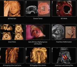 Mindray Imagyn I9 Full HD Diagnostisch Echografie Systeem Kleuren <span class=keywords><strong>Doppler</strong></span> Echografie Apparaat met 4 Transducer Probes - Product Image 6