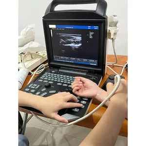 SYA-M5 en çok satan taşınabilir ultrason Zoncare M5 veteriner renkli Doppler ultrason makinesi