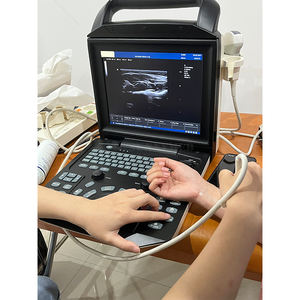 SYA-M5 penjualan terbaik portable <span class=keywords><strong>ultrasound</strong></span> Zoncare M5 mesin <span class=keywords><strong>Ultrasound</strong></span> <span class=keywords><strong>Doppler</strong></span> warna hewan - Product Image 1