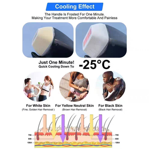 Máquina Profesional de Depilación Láser de Diodo 755nm 808nm 1064nm Doble Pulso con Enfriamiento por Hielo, Aprobada por CE, para Uso en Salón - Product Image 3