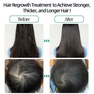 Aceite de Ricino 100% Puro y Natural, Prensado en Frío, Orgánico, Fortalece el Crecimiento y Repara el Cabello, Aceite de Ricino Negro, Venta al Por Mayor - Product Image 4