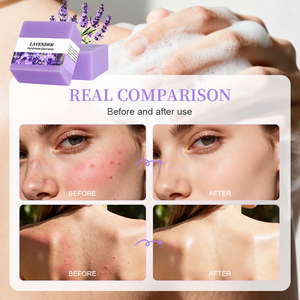 Jabón de <span class=keywords><strong>Lavanda</strong></span> Orgánico - Aromaterapia Relajante, Limpieza Profunda y Protección de la Piel, Alivia la Sequedad y Repara la Piel Sensible y Frágil - Product Image 4
