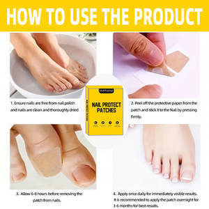 Patchs de traitement des ongles marron 88 pièces, autocollants correcteurs antifongiques pour ongles incarnés, soin des ongles abîmés et paronychie - Product Image 2