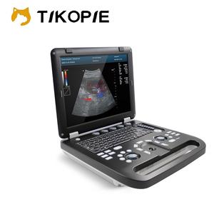 Mesin <span class=keywords><strong>Ultrasound</strong></span> Portabel Warna Doppler Komprehensif Tikopie CMS1700C-VET Multi-Spesialisasi 15 inci dengan Perangkat Lunak PC - Product Image 1
