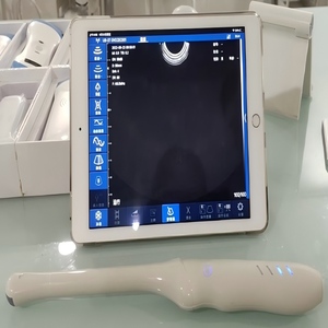 Dos Versiones de Sonda Endocavitaria Ginecológica Inalámbrica DMU92, Sonda de Ultrasonido Doppler Color para Diagnóstico Ginecológico Humano - Product Image 1