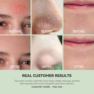 U-zona pulizia grigio <span class=keywords><strong>argilla</strong></span> profonda pulizia olio di controllo con acido ialuronico <span class=keywords><strong>argilla</strong></span> bianca per la rimozione punti neri rinfrescare la pelle - Product Image 5