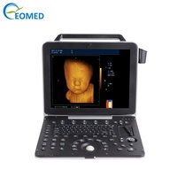 Échographe Doppler Couleur Portable 3D/4D en Temps Réel pour Obstétrique/Gynécologie, Écran LED 15 Pouces de Qualité Médicale, Garantie 1 An