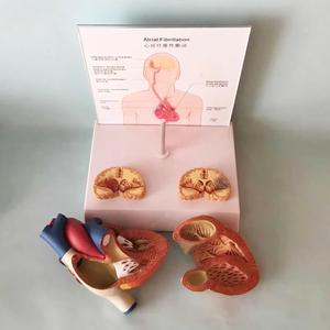 Modelo Anatómico de Fibrilación Atrial con Secciones Transversales de Corazón y Cerebro para la Enseñanza de Cardiología - Product Image 2