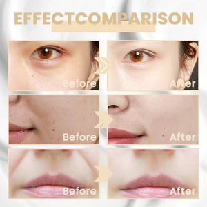 2025 Professionnel Salon Clinicals Formulé <span class=keywords><strong>Vitamine</strong></span> <span class=keywords><strong>C</strong></span> Avancé Éclaircissant Rétinol Crème Raffermissante Collagène Lotion De Sauvetage De La Peau - Product Image 4