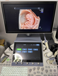 Fourniture et réparation de la machine à ultrasons VoLuson E8 - Product Image 2