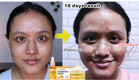 Sabun Kunyit Minyak Krim Wajah Set Perawatan Kulit Tiga Buah Gliserin Shea Butter Vegan Anti-Penuaan Pemutih Pelembab Hyaluronic
