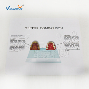 Maniquí <span class=keywords><strong>de</strong></span> PVC Ecológico para Demostración <span class=keywords><strong>de</strong></span> Dientes Saludables con Manchas <span class=keywords><strong>de</strong></span> Tabaco, para Estomatología, Higiene Bucal, Enseñanza en Laboratorio, E/ISO/ROHS/CNAS - Product Image 5