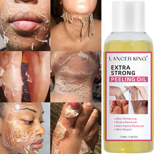 Aceite Exfoliante Extra Fuerte, Eliminador de Manchas Oscuras, Eliminación de Piel Muerta, Aclara el Tono de la Piel - Product Image 1