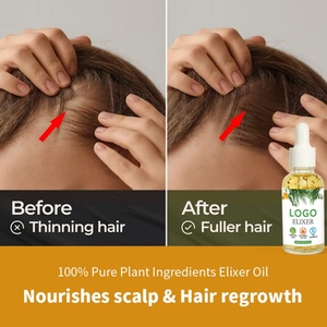 เซรั่มน้ำมันบำรุงผมสูตรธรรมชาติน้ำมันบำรุงหนังศีรษะทำให้ผมงอกเร็วน้ำมันฮารีออแกนิคโลโก้ได้ตามต้องการ - Product Image 2