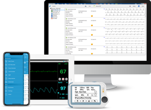 Checkme <span class=keywords><strong>Monitor</strong></span> tekanan darah untuk pasien Ecg, <span class=keywords><strong>Monitor</strong></span> tanda <span class=keywords><strong>Vital</strong></span> untuk rumah sakit - Product Image 6