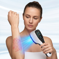 Appareil laser excimer portable LED 308 nm Kernel KN 5000G, lumière UVB 308 nm efficace pour le traitement de diverses affections cutanées, vitiligo