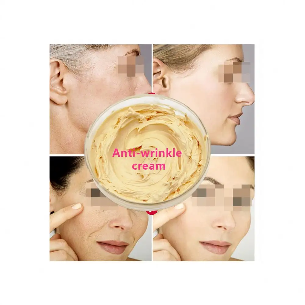 अंधेरे स्थान दाना हटाने Skinmiso ताकना शून्य रात क्रीम विटामिन एक Hyaluronic एसिड कोलेजन त्वचा उम्र बढ़ने विरोधी शिकन चेहरा क्रीम