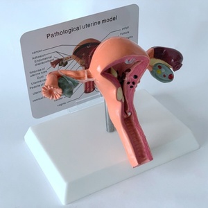 Modelo de Útero Femenino de Alta Calidad, Modelo de Útero Fantómico - Product Image 3