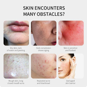 جل لتقشير الوجه الطبيعي العضوي الخاص الأفضل مبيعًا, جل لترطيب الوجه من حمض الهيالورونيك ، جل لترطيب الوجه من مادة الهلام ذو العلامة التجارية الخاصة ، من المنتجات الأكثر مبيعًا ، جل لترطيب الوجه من حمض الهيلارونيك - Product Image 2