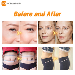 4D mặt nâng chống lão hóa cơ thể Máy giảm béo với 8 hộp Mực 11 dòng thắt chặt da thắt chặt 2 trong 1 chống nhăn ma - Product Image 5