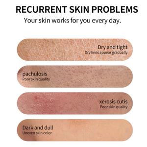 Tónico Facial Hidratante e Iluminador con Vitamina C Qingying de 250 ml para el Cuidado de la Piel, Venta al por Mayor - Product Image 2