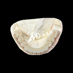 Pont Implantable Premium |   Base en titane avec couronne en céramique pour une restauration dentaire fiable | pour laboratoire ou clinique - Product Image 3